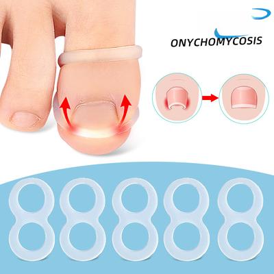 Nouveau Anneau d'Ongle Incrusté à l'Orteil Étirement Rebond Sillon d'Ongle Courbe Étirement Physique Peut Marcher, Peut Être Lavé et Réutilisé