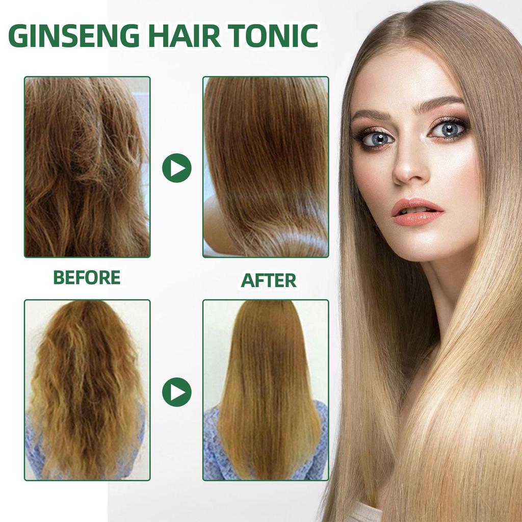 OUHOE Ginseng Hair Growth Serum 100ml: Ginseng extract promotes hair growth, strengthens hair, prevents hair loss, and moisturizes hair.