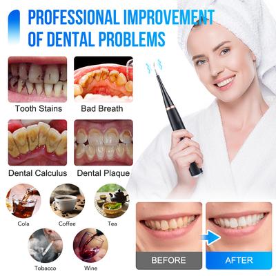 6v1 Ultrasonic Dental Cleaner Scaler Zubní kámen Odstraňovač zubního kamene Elektrický zubní kartáček Sonický čistič zubního plaku Čistič zubů