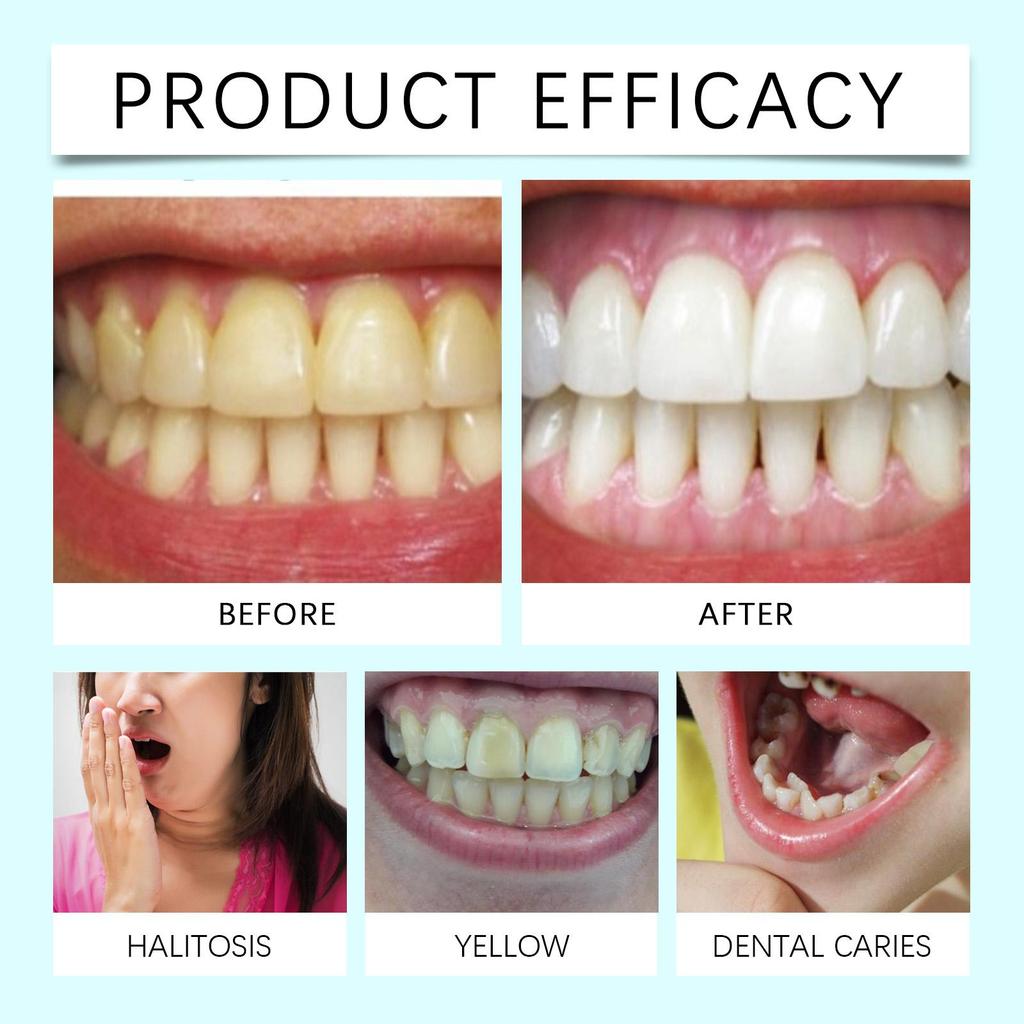 Premium Mundpflege Zahnaufhellungsstreifen, Frischer Atem & Fleckenentfernung - Zahnschmelzsicher für den täglichen Gebrauch
