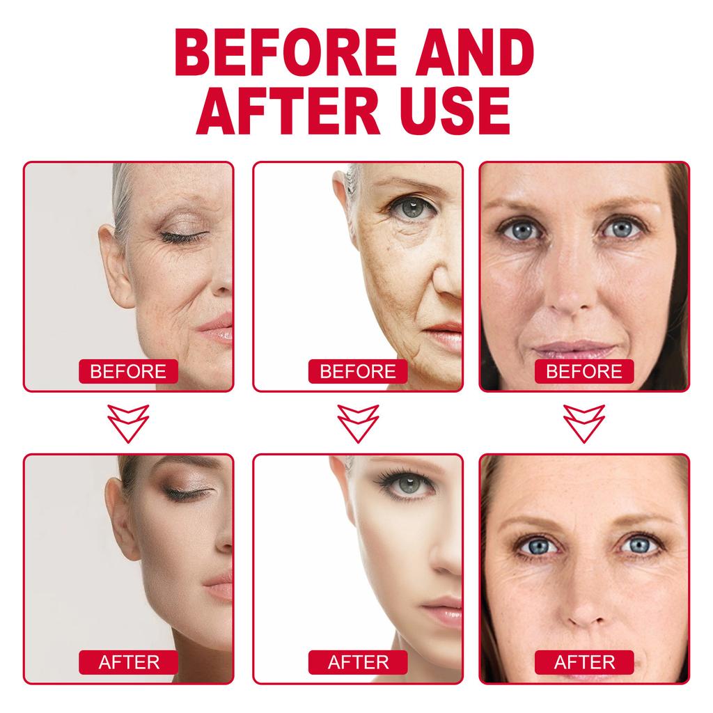 EELHOE Retinol Remove Dark Circles Eye Serum Eye Bags Lift Firm Brightening Κρέμα ματιών Υαλουρονικό Οξύ Μασάζ κατά των ρυτίδων Περιποίηση ματιών
