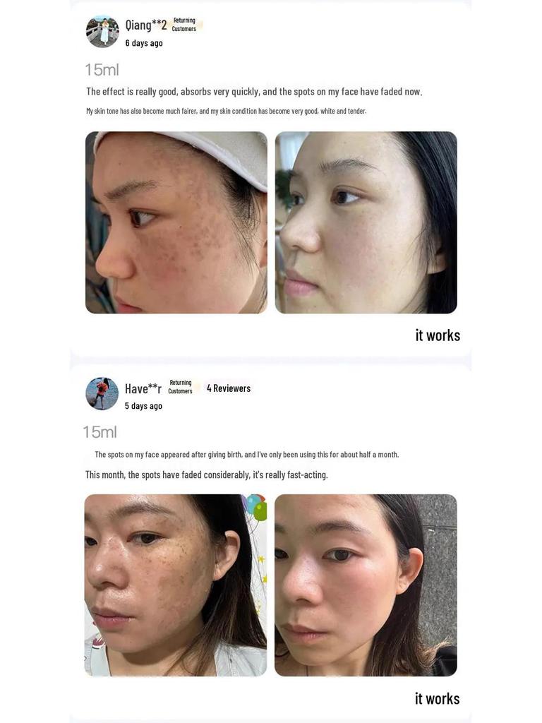 Han Bei Dan White Oil - Whitening & Freckle Removal Essence