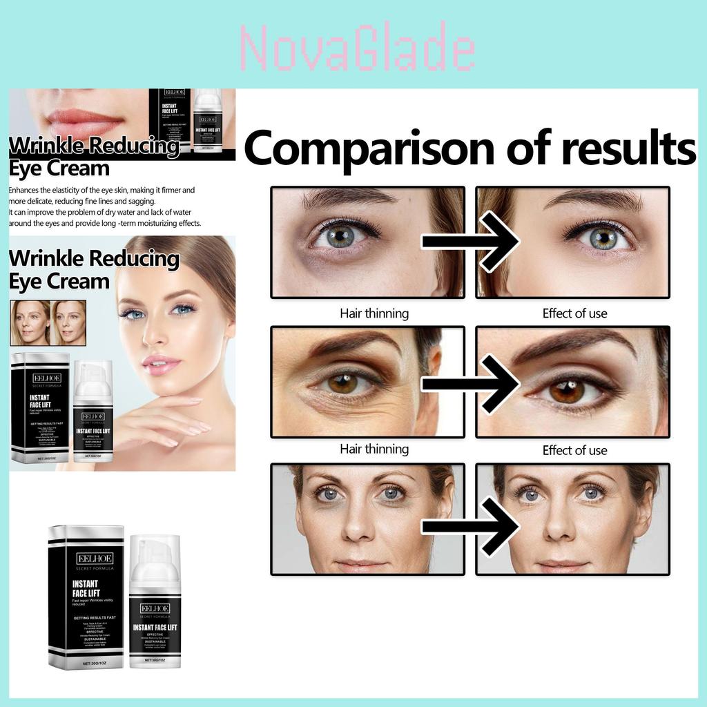 Eelhoe Eye Firming Cream Anti Aging Formula For Dark Circles And Wrinkles 30g