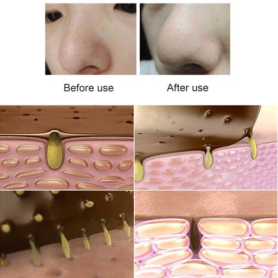 10Pcs Blackhead Acne Remover Nose Cover Sticker Pore Cleaning Strip Skin Care