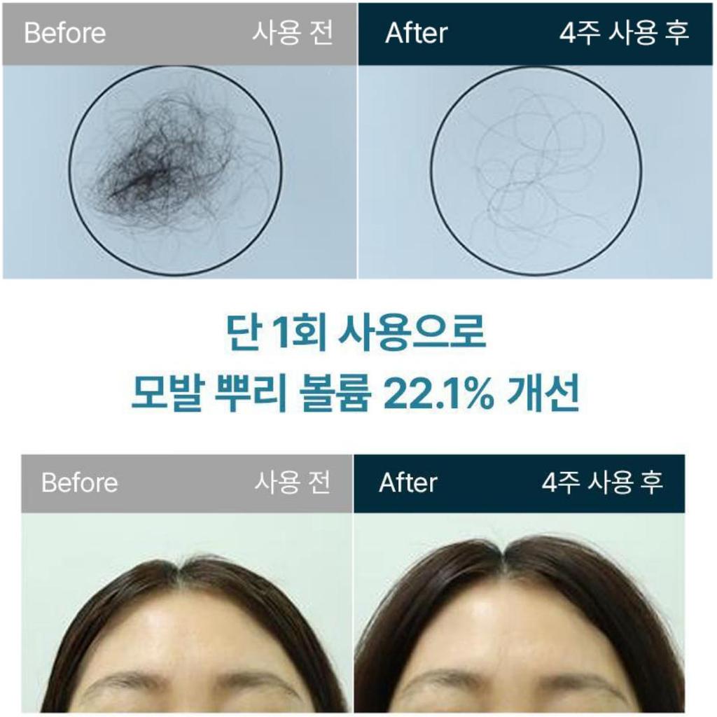 [Solep] Hair Loss Intensive Improvement Scalp Ampoule Pack 40mlX2