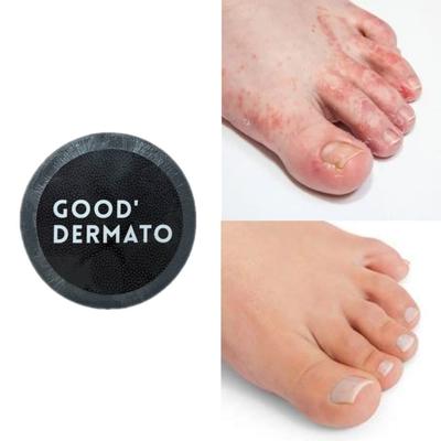 Bon Dermato Pieds & Ongles Mediclear Savon 115g (Lave et résout les callosités/odeur/humidité/croûtes entre les orteils), 1 unité