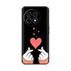 For OnePlus ACE5 Case Soft Silicone Ultra Slim Fashion Animal Phone Cases For OnePlus ACE 5 Pro Back Cover For OnePlus 13R Coque