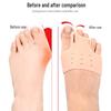Silicone Hallux Valgus & Little Toe Corrector with Shock Absorber