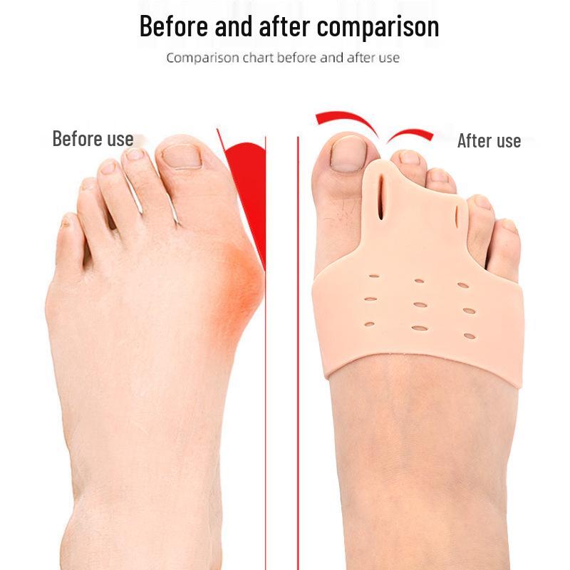 Silicone Hallux Valgus & Little Toe Corrector with Shock Absorber