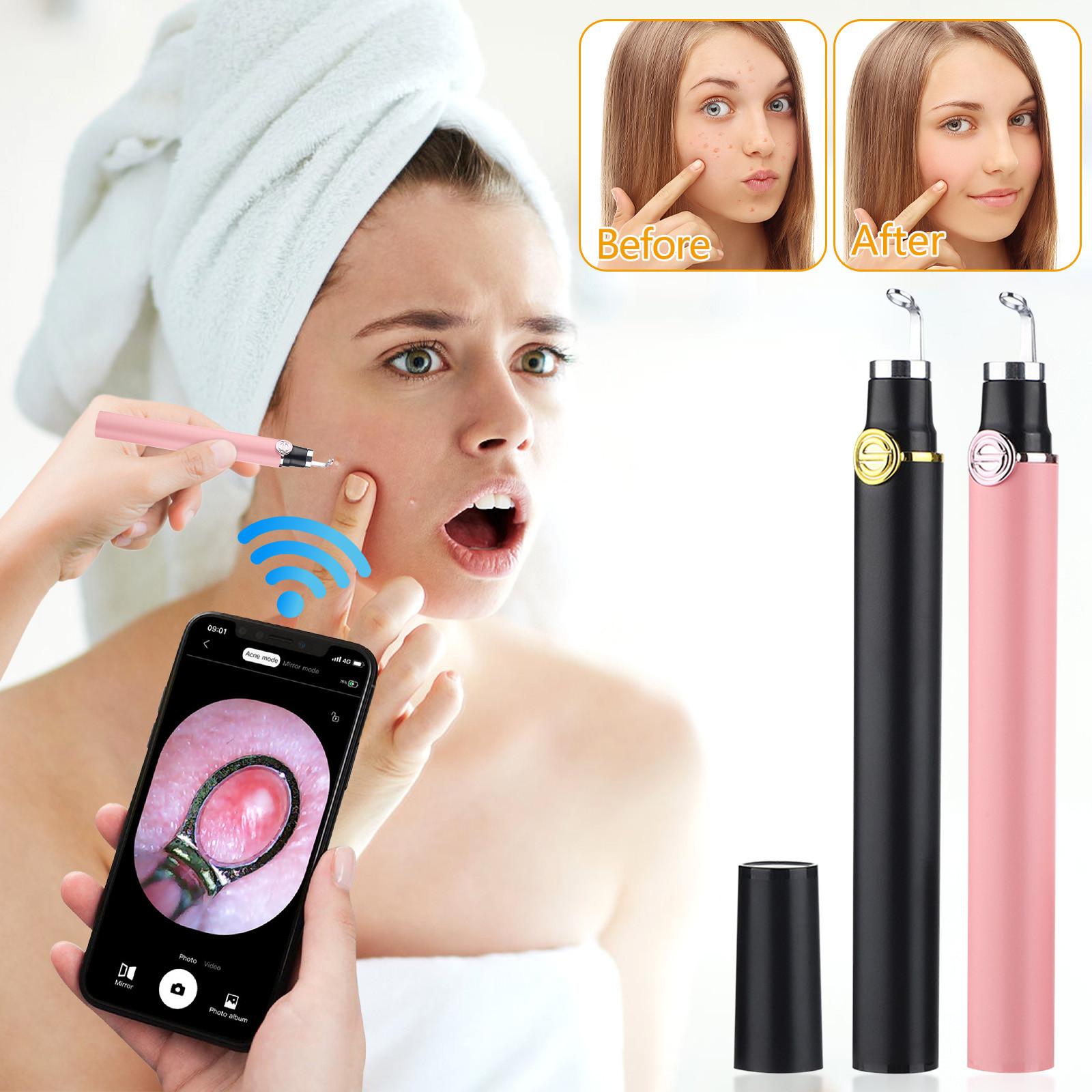 

Візуальна голка від прищів Інтелектуальне видавлювання вугрів WiFi HD камера Видавлювання прищів Світяться прищі чорний