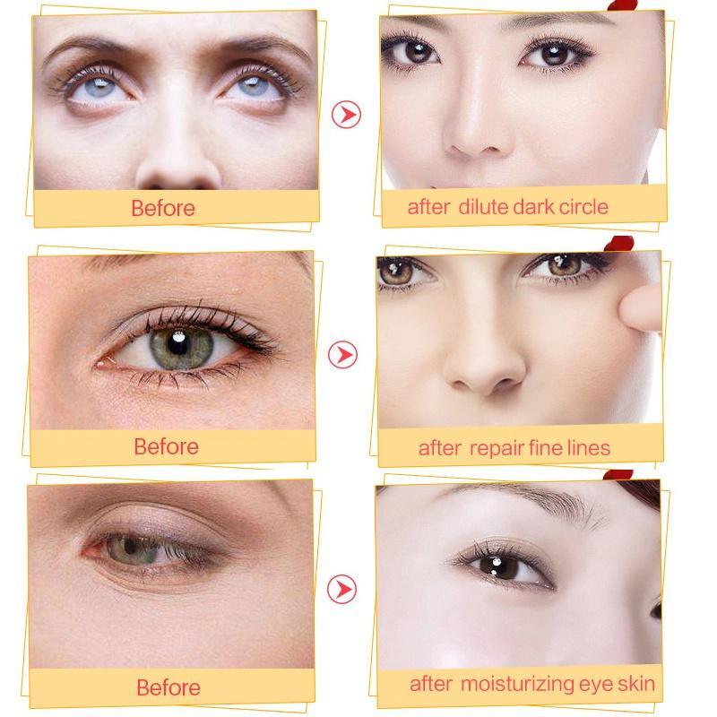 10Pair 24K Gold Collagen Eye Mask Anti-Aging Hyaluronic Acid Eye Patches Under Eye Mask