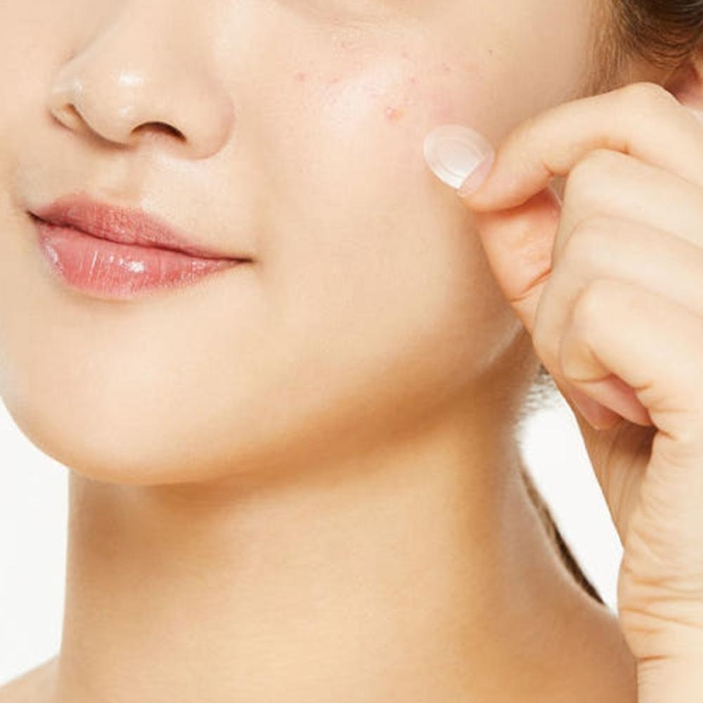 COSRX AC Collection Acne Pimple Master Patch 26 patches (5 packs)