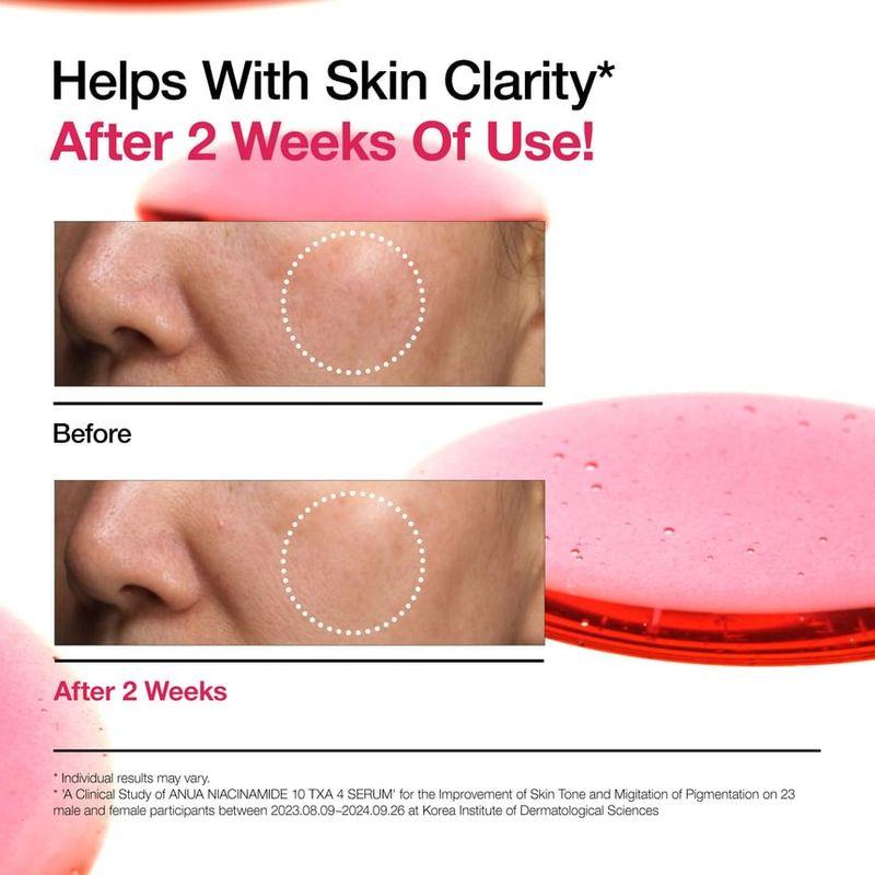 Anua Niacinamide 10 TXA 4 Serum