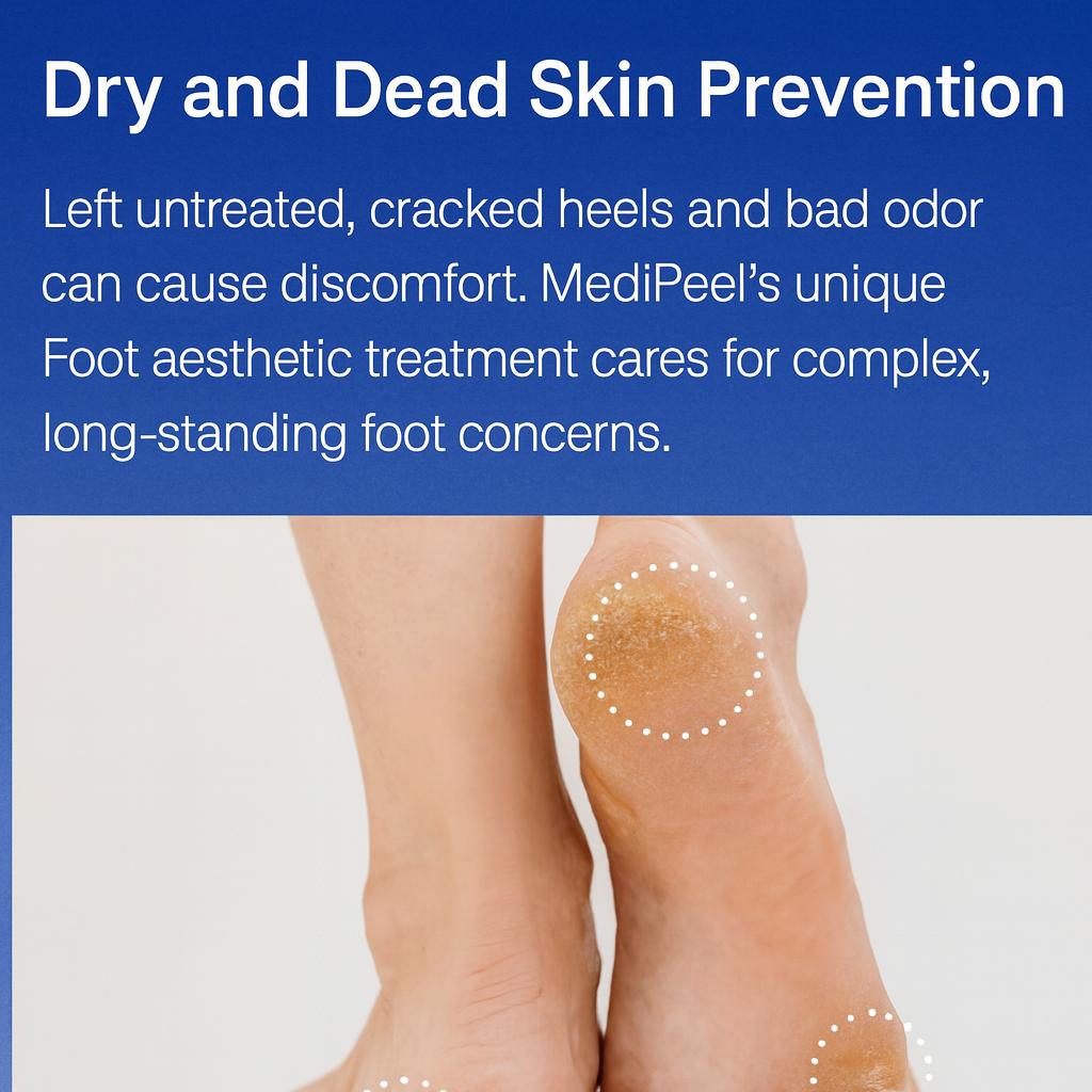 MEDI-PEEL EGF Crème Hydratante pour les Pieds Scalpante 130g