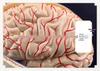 Natural Size Head Anatomy Model with Cerebral Arteries, 4-Part Mid-Sagittal Brain Section