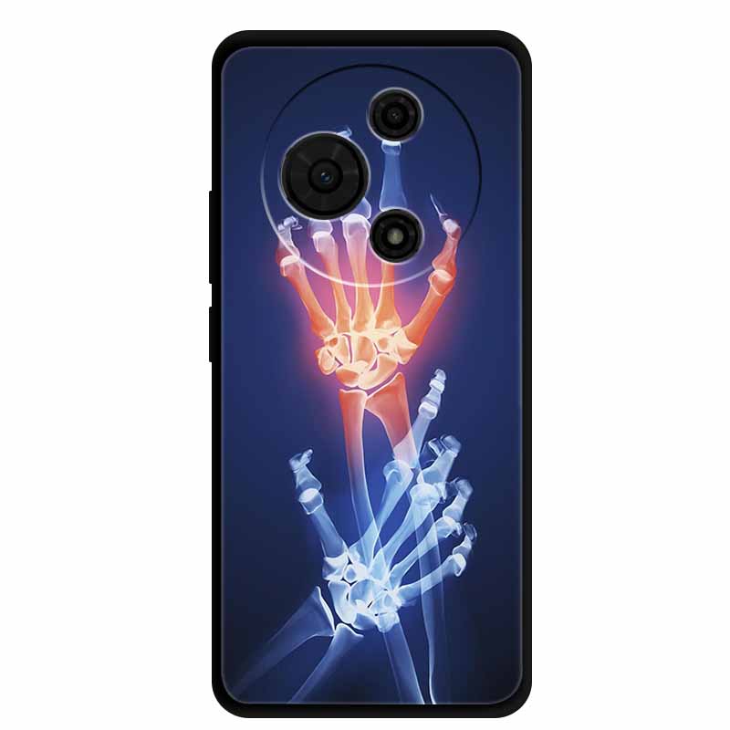 For TCL 605 Case 6.7” Cartoon Animal Shockproof Silicone Soft TPU Funda For TCL 605 Back Cover Protective Nubia Coque Military