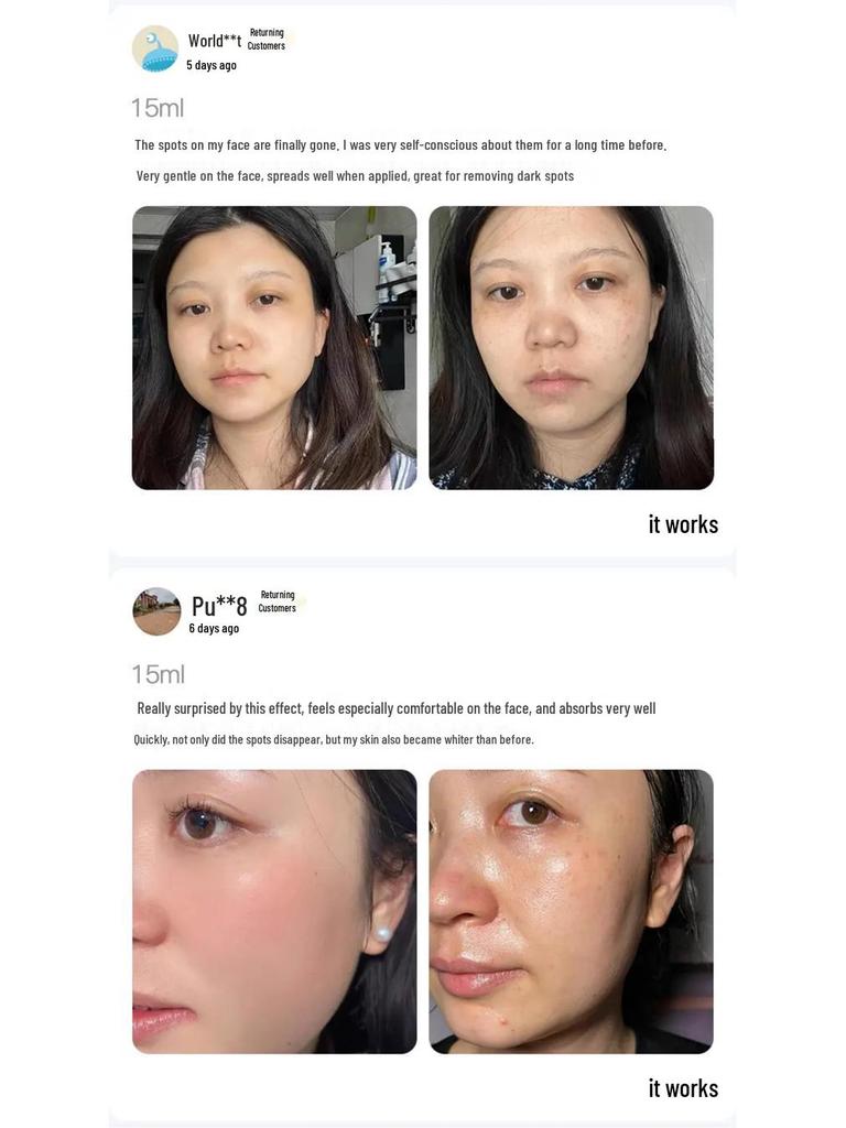 Han Bei Dan White Oil - Whitening & Freckle Removal Essence