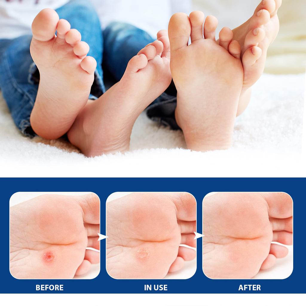 Extra Stärke – Nagelpflaster – 8-Stunden-Pflaster für die Zehennägel für die Nacht – 32 Stück