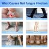 Ingrown Toenail Sticker Corrector Patches Big Toe Nail Corrector Renewal Plaster