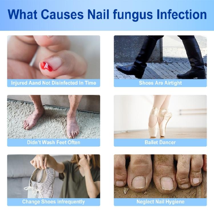 Ingrown Toenail Sticker Corrector Patches Big Toe Nail Corrector Renewal Plaster