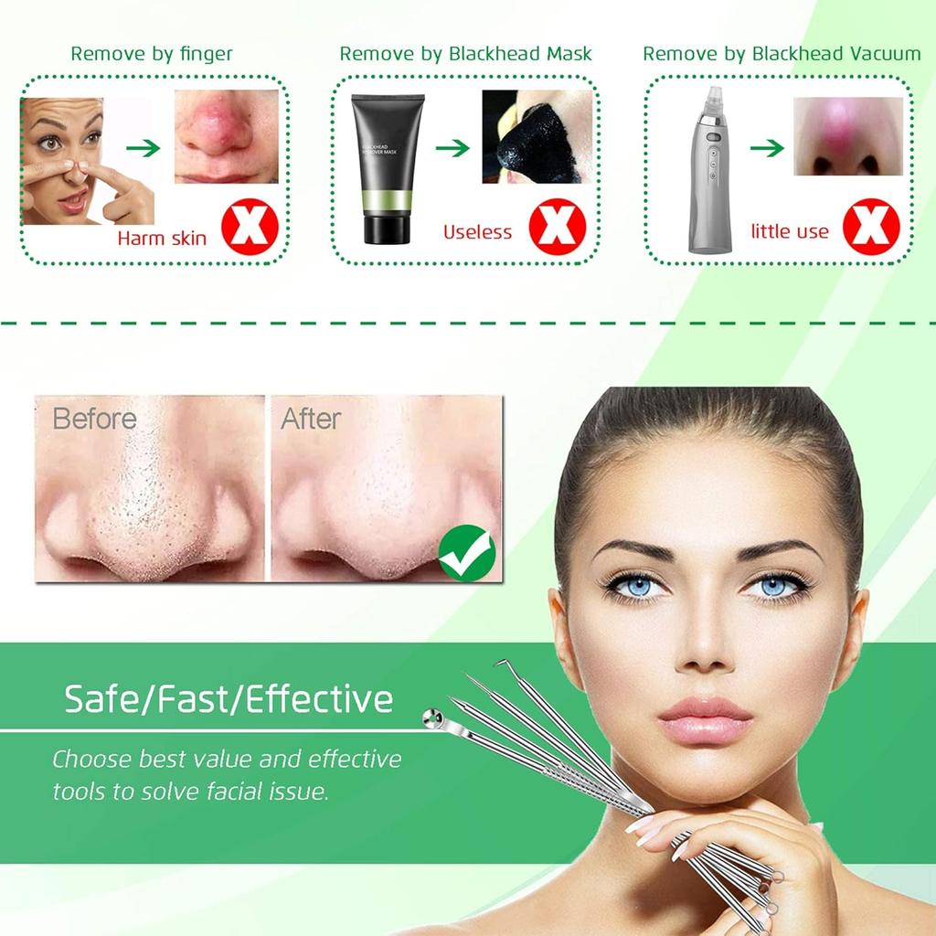 Acne Needle Tool Sets 5 Pcs Stainless Steel Blackhead Remover Pimple Tweezers Extractor Comedone Extractor Tool Blemish Remover Kit with Case