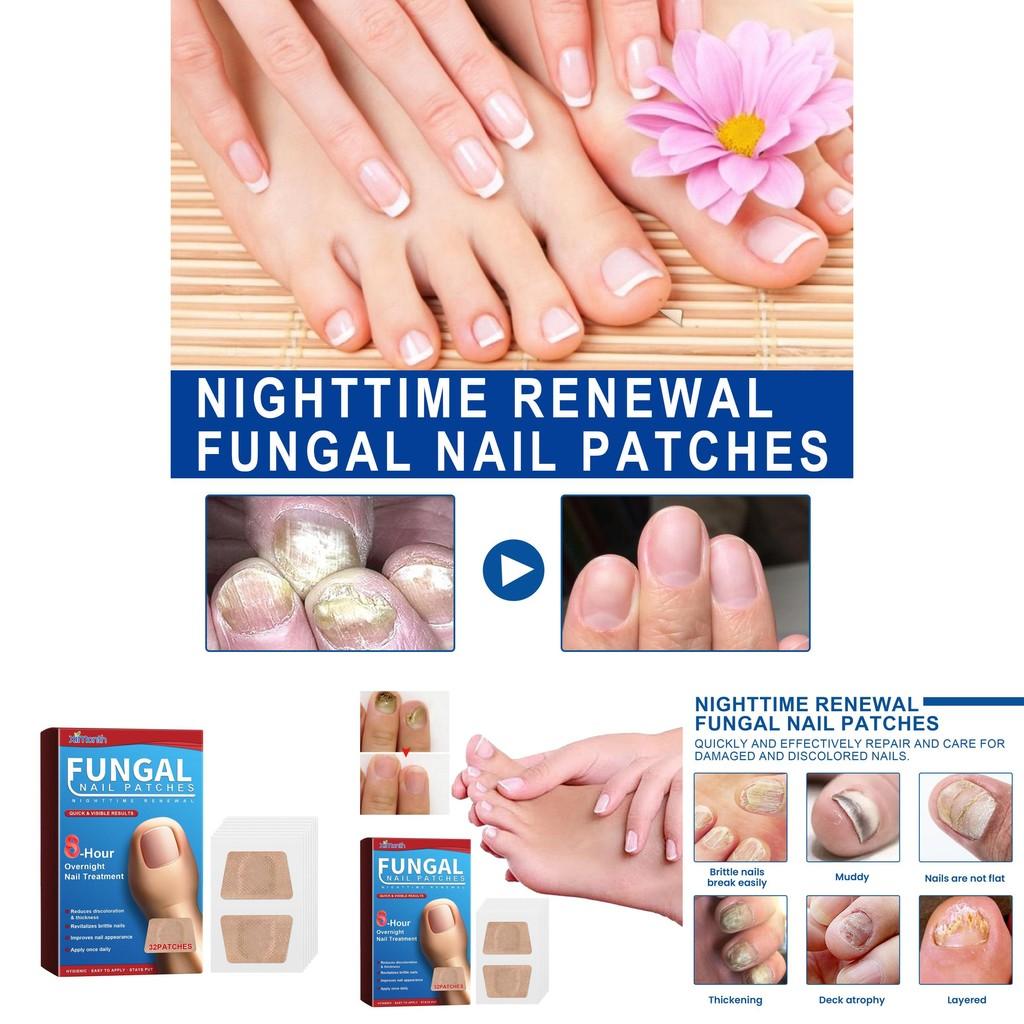 Ximonth Nighttime Nail Care Patches For Strengthening And Healing Weak Nails