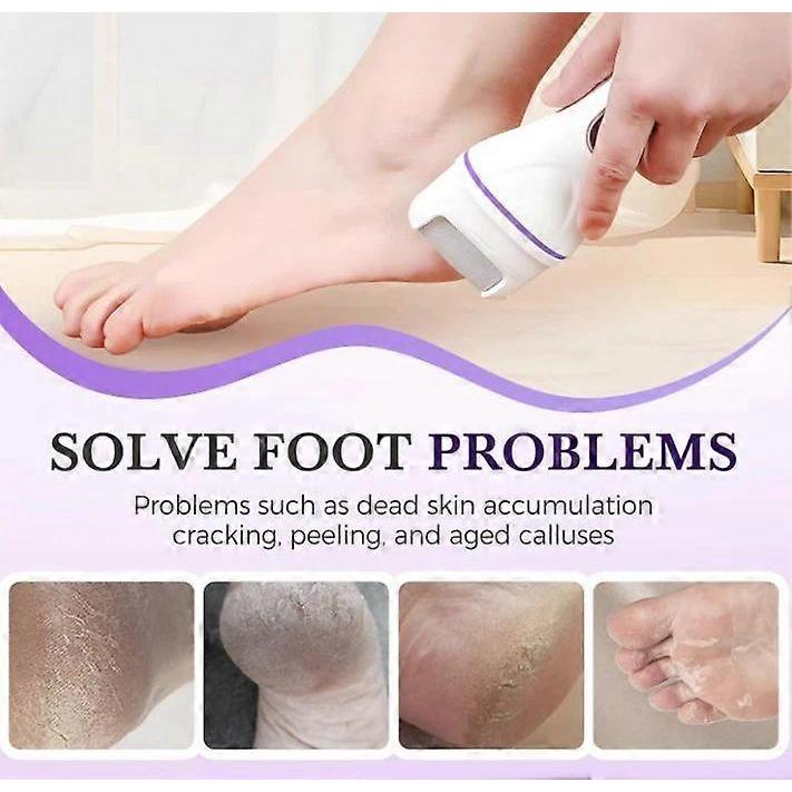 Elektrische Fußfeile Hornhautentferner Professioneller Fußschleifer Pediküre-Maschine Werkzeuge Wiederaufladbar Ferse Rissige Tote Haut Schrubber