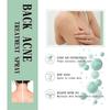 Back Acne Repair Spray Fades Pockmarks Repair Back Back Shoulder Acne 120ml
