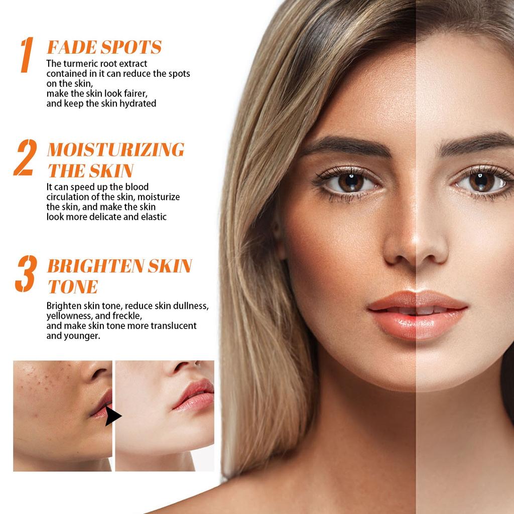 Lighten Facial Freckles Dark Spots Brightening Moisturizing Skin Lotion