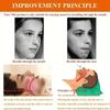 Anti-snoring Band Open Mouth Breathing Corrective Anti-snoring Chin Rest Sleep Open Mouth Rest