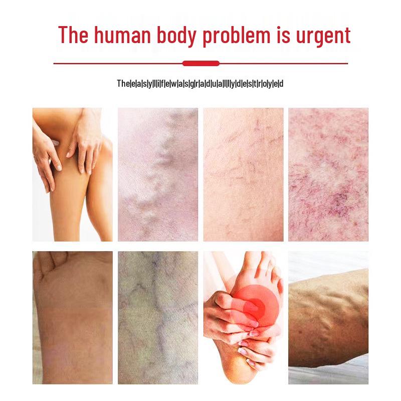 Far-Infrared Anti-Inflammatory Varicose Veins Gel