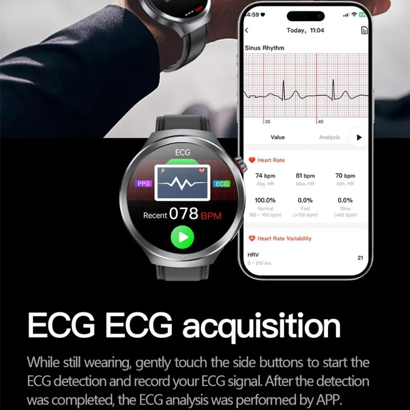 2025 Ny EKG+PPG Smartklokke Lipider Urinsyre Blodtrykk Helseklokke Menn NFC-tilgang 100+Sport HD Bluetooth Samtale Klokke Kvinner