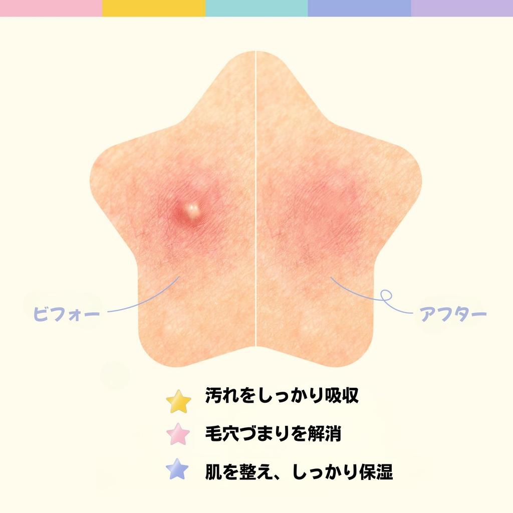 #OOTD Star Spot Patches for Face, Hydrocolloid, Niacinamide, Ceramide, Cute Pastel Colors, Transparent, Made In Korea, 80 Patches