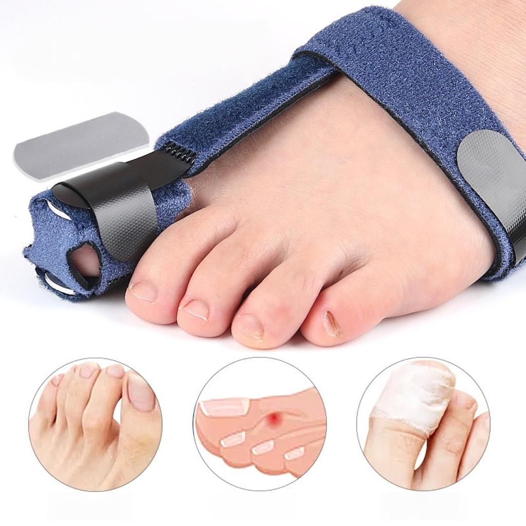 Adjustable Toe Fixation Strap Fixation Splint Detachable Aluminum Plate Support Toe Protector Toe Corrector Bunion Straightener
