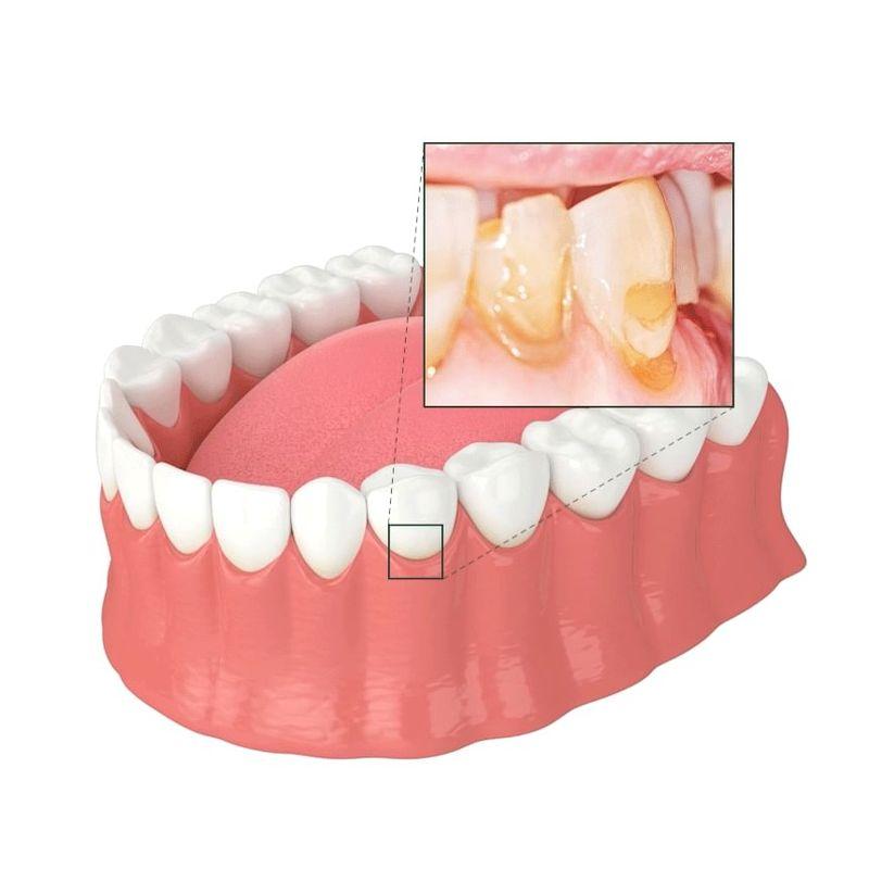 ViveLab - Green Care Sensitive Toothpaste