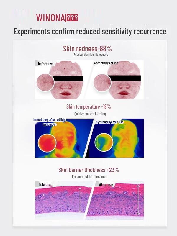 Winona Second Gen Special Care Cream