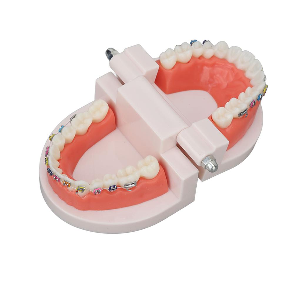 Dental Typodont Teeth Model with Orthodontic Metal Bracket for Dentist Teaching Research Dental Laboratory