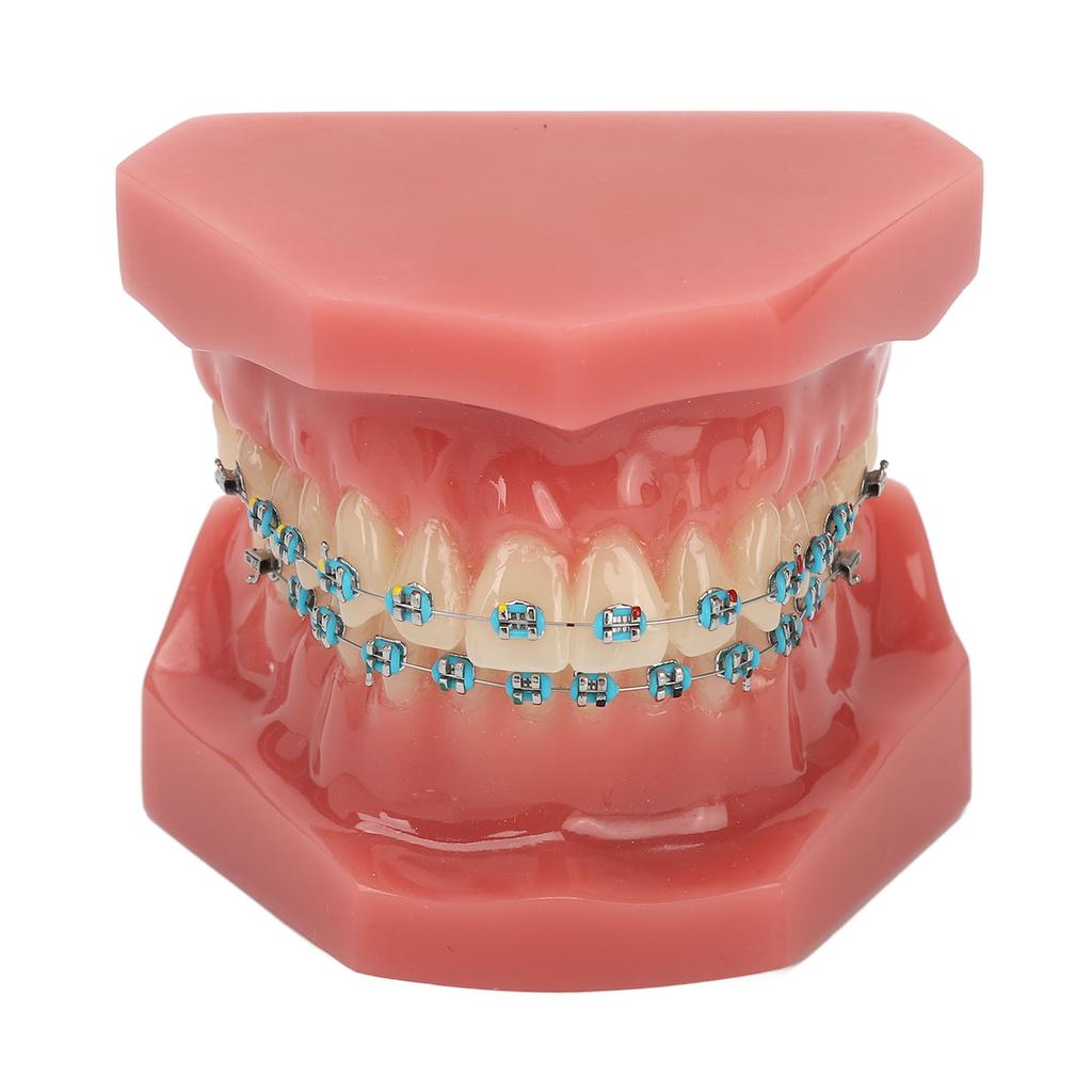 Zahnärztliches Kieferorthopädisches Modell 28 Zähne Harz Zahnärztliches Lehrmodell Zähne mit Metallbrackets
