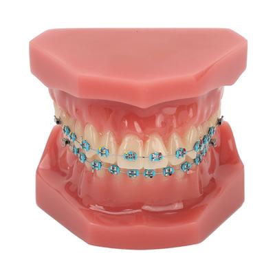 Zahnärztliches Kieferorthopädisches Modell 28 Zähne Harz Zahnärztliches Lehrmodell Zähne mit Metallbrackets