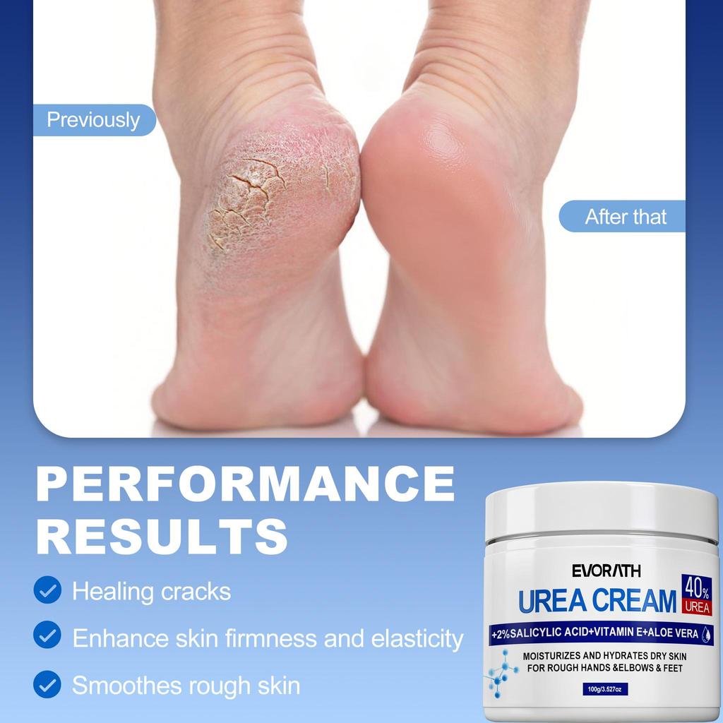 60% Urea Cream, For Rough Hands And Feet, With Vitamin E & Aloe Vera,  Enhances Radiance And Provides Deep Hydration-100G