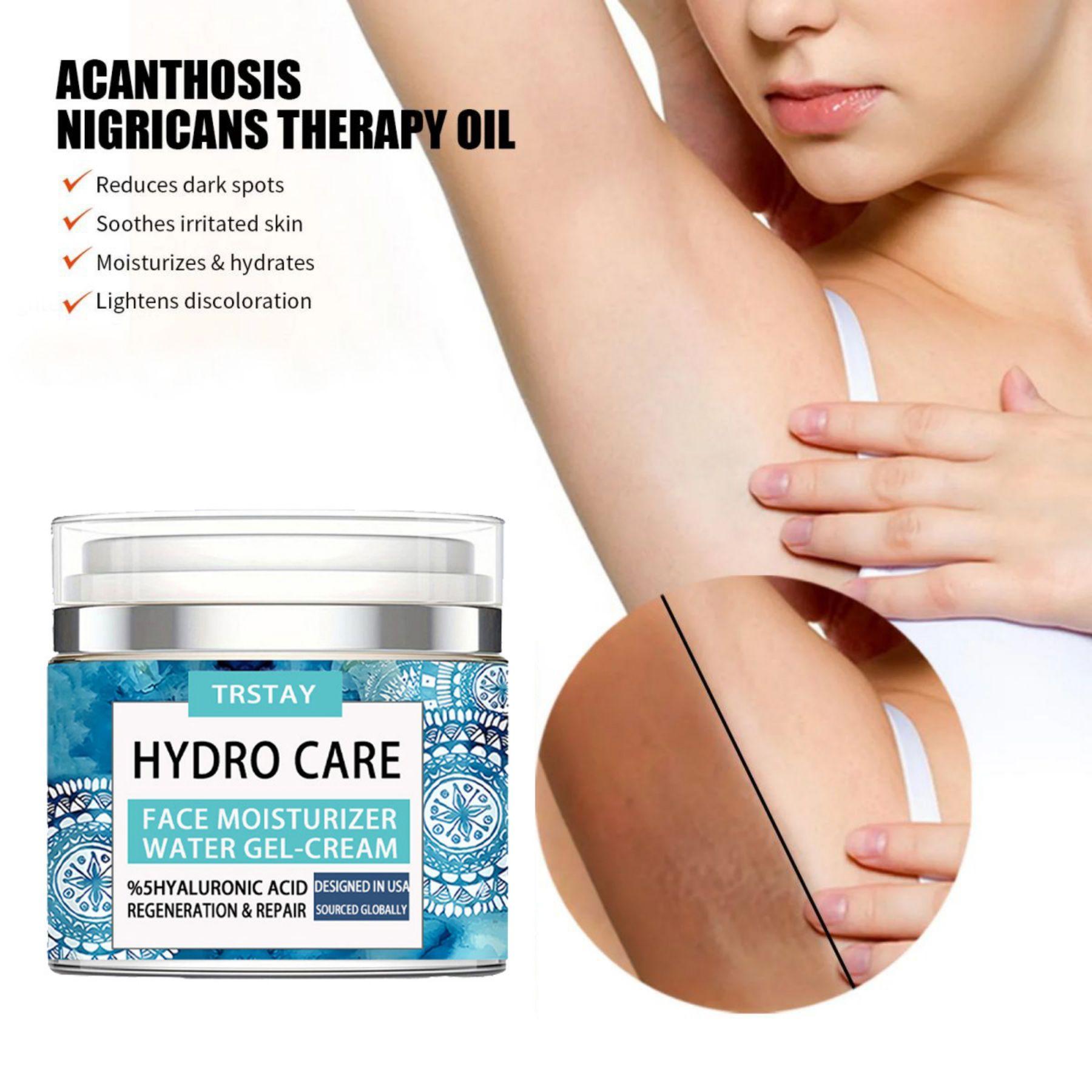 

5G/15G/30G/50G/Осветляет темные круги, сужает поры, улучшает текстуру кожи, попрощается с тонкими линиями, увлажняет, подтягивает кожу, крем для лица