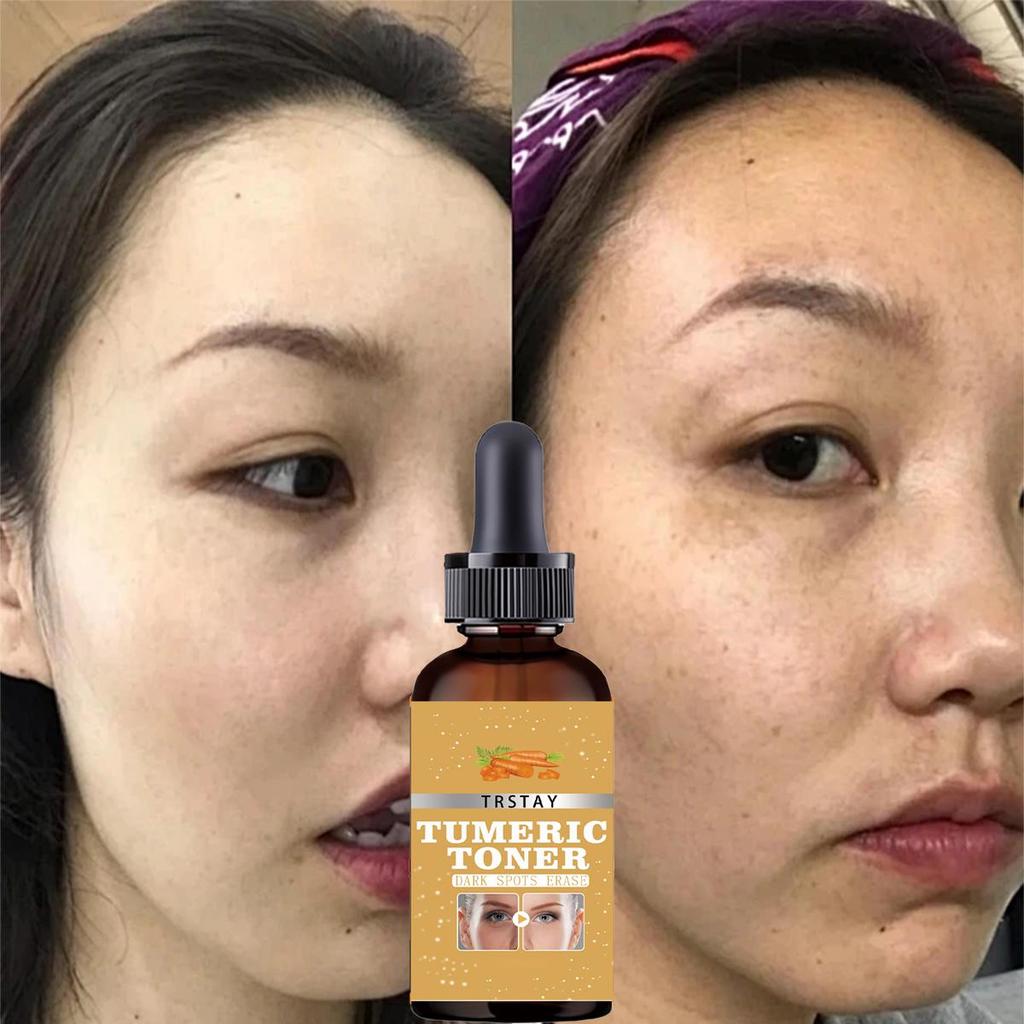 Turmeric Oil Deep Moisture Serums Brighten Fade Dark Spot Removal Pigment Melanin Correcting Beauty Face Skin Care