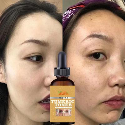 Zerdeçal Yağı Derin Nem Serumları Aydınlatmak Solmaya Karanlık Nokta Kaldırma Pigment Melanin Düzeltici Güzellik Yüz Cilt Bakımı