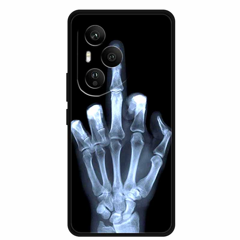 Phone Case For Honor 400 Pro Global Soft Silicone Funda TPU Coque Cover for Honor 400 Pro DNP-NX9 Cartoon Capa Honor400 Pro 5G