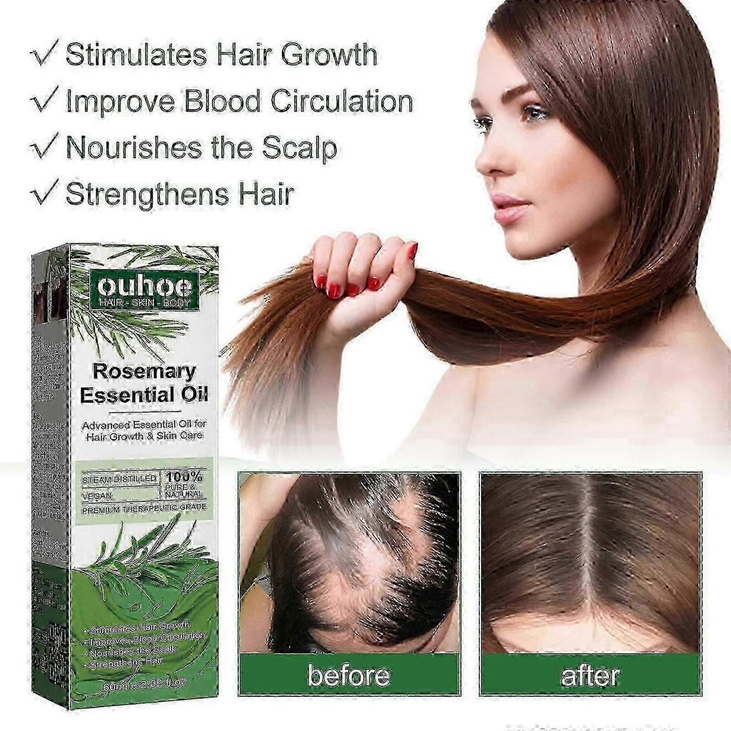 OUHOE rosemary hair thickening essential oil, prevents hair breakage and hair loss, strengthens and nourishes hair roots, and provides dense hair New 