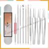 MYONLY Blackhead & Pimple Tweezers - Double-Ended Zit Removal Tool