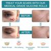 1 Roll Silicone Gel Scar Sheet Patch Treatment Removal Tape Cover Burn Trauma Repair Acne Ear Scar Section Beauty Skin