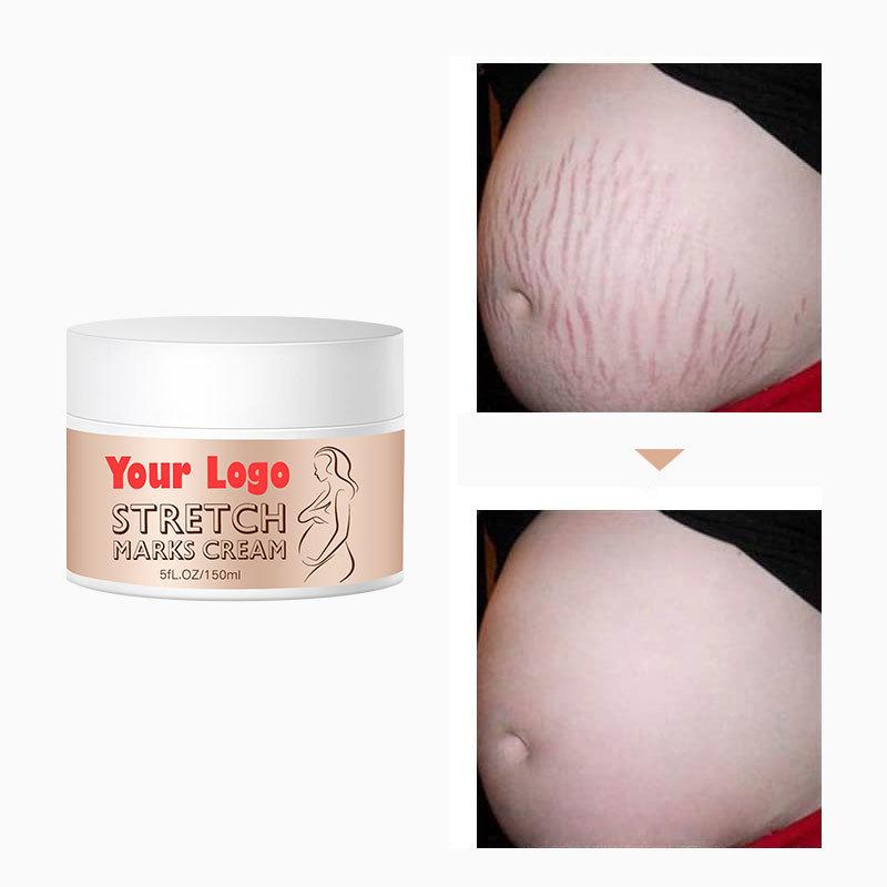 Best Selling Natural Organic Anti Pregnant Scar Skin Care Repair Treatment Cream