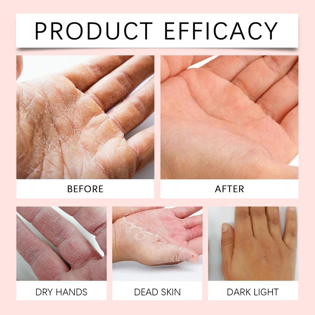Retinol Hand Cream Firming Hand Lotion Retinol Moisturizer For Aging Dry Cracked Hands Hydrates & Soothes Dry Hands Non-Greasy