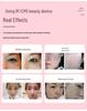 Home Facial Massager: Nasolabial Lift, Firming & Photon Rejuvenation Cleanser